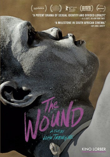 Wound (2017) (2017)