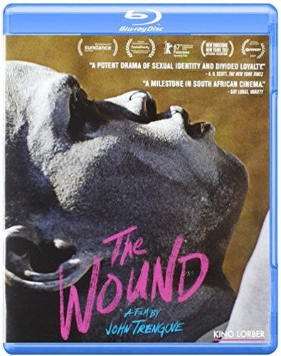 Wound (2017) (2017)