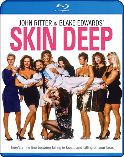 Skin Deep Bd (1989)